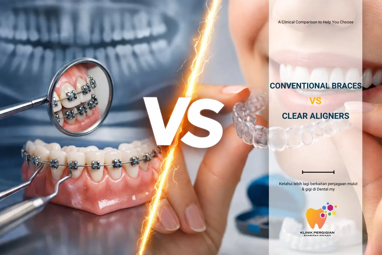 Conventional Braces vs Clear Aligners: A Clinical Comparison to Help You Choose