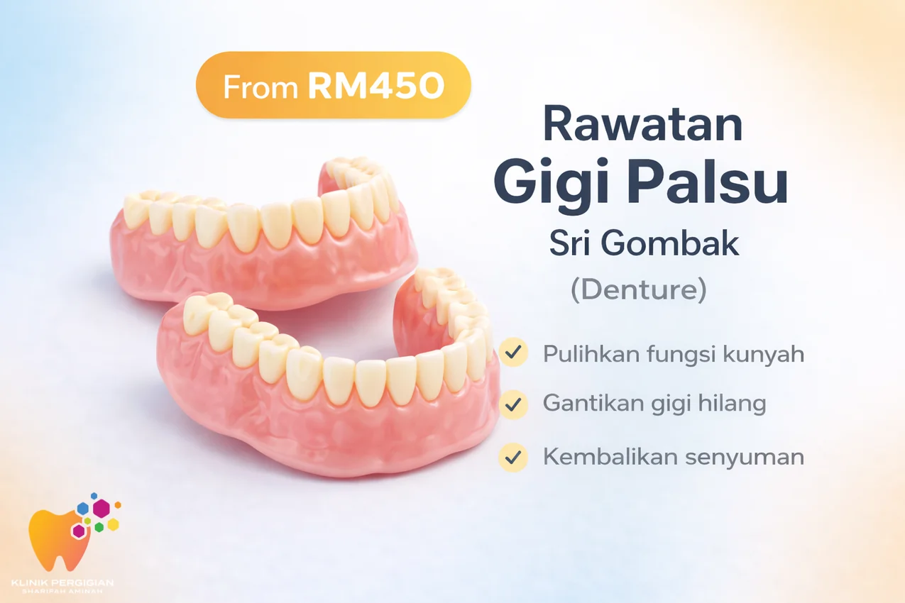 Rawatan gigi palsu denture untuk menggantikan gigi hilang di Klinik Pergigian Sharifah Aminah di Sri Gombak