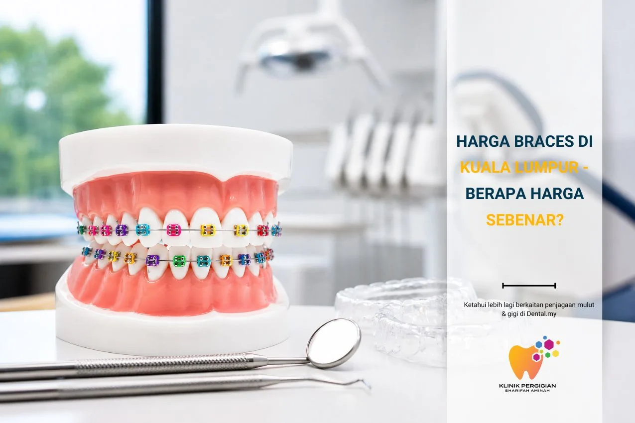 Harga Braces di Kuala Lumpur 2026 – Berapa Harga Sebenar?