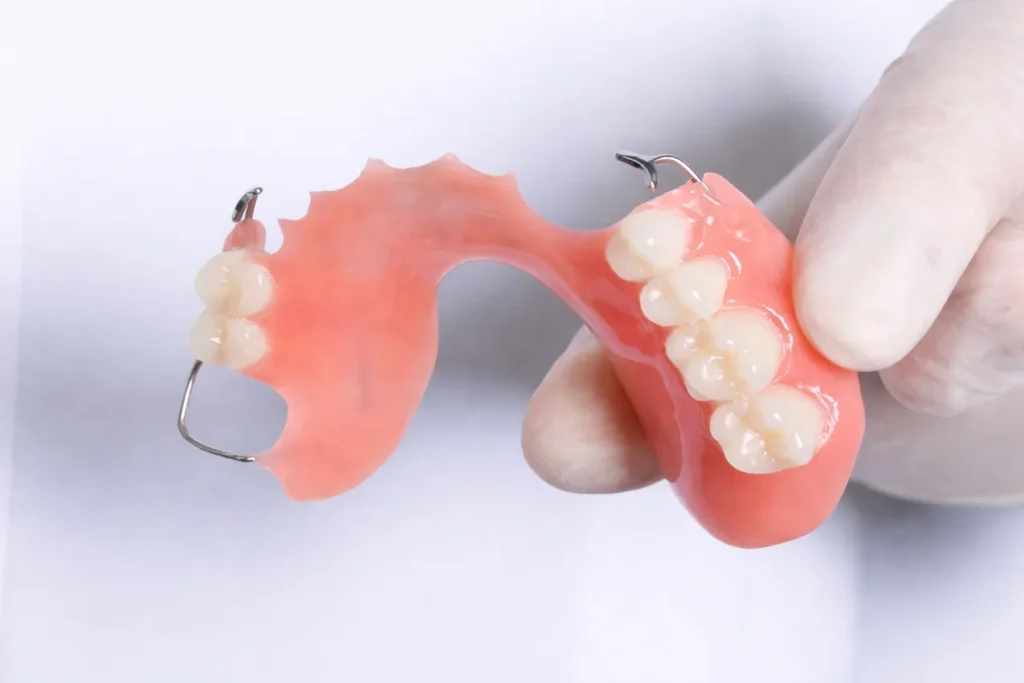 Jenis gigi palsu acrylic di klinik pergigian sharifah aminah