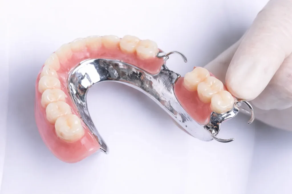 Jenis gigi palsu cobalt chrome di klinik pergigian sharifah aminah