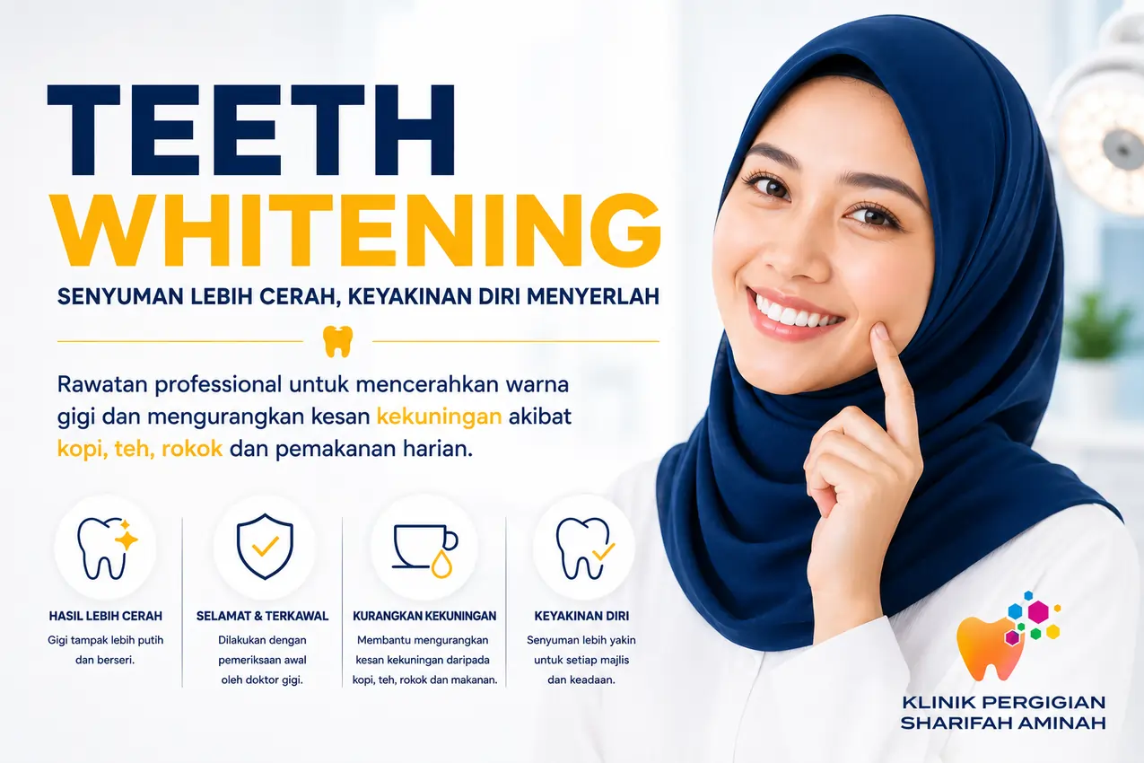Rawatan teeth whitening di Klinik Pergigian Sharifah Aminah Kuala Lumpur.