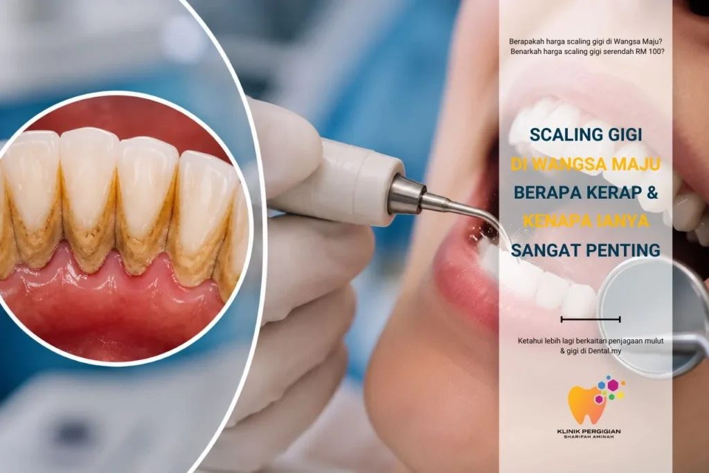 Scaling Gigi di Wangsa Maju — Berapa Kerap & Kenapa Penting?