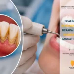 scaling gigi di Klinik Pergigian Sharifah Aminah Wangsa Maju