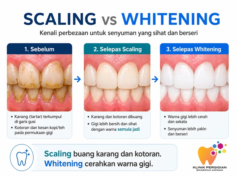 Perbandingan hasil scaling gigi dan whitening gigi — dua rawatan berbeza untuk tujuan berbeza
