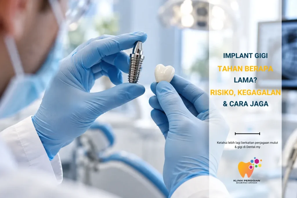 Implant Gigi Tahan Berapa Lama? Risiko, Kegagalan & Cara Jaga
